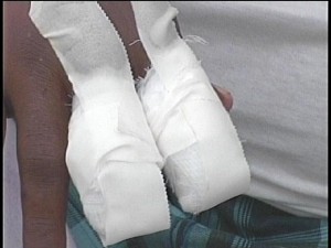 jose cruz fingers