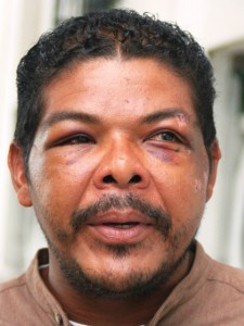 Elvin Torres